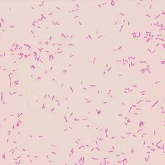 Yersinia Pseudotuberculosis Infection